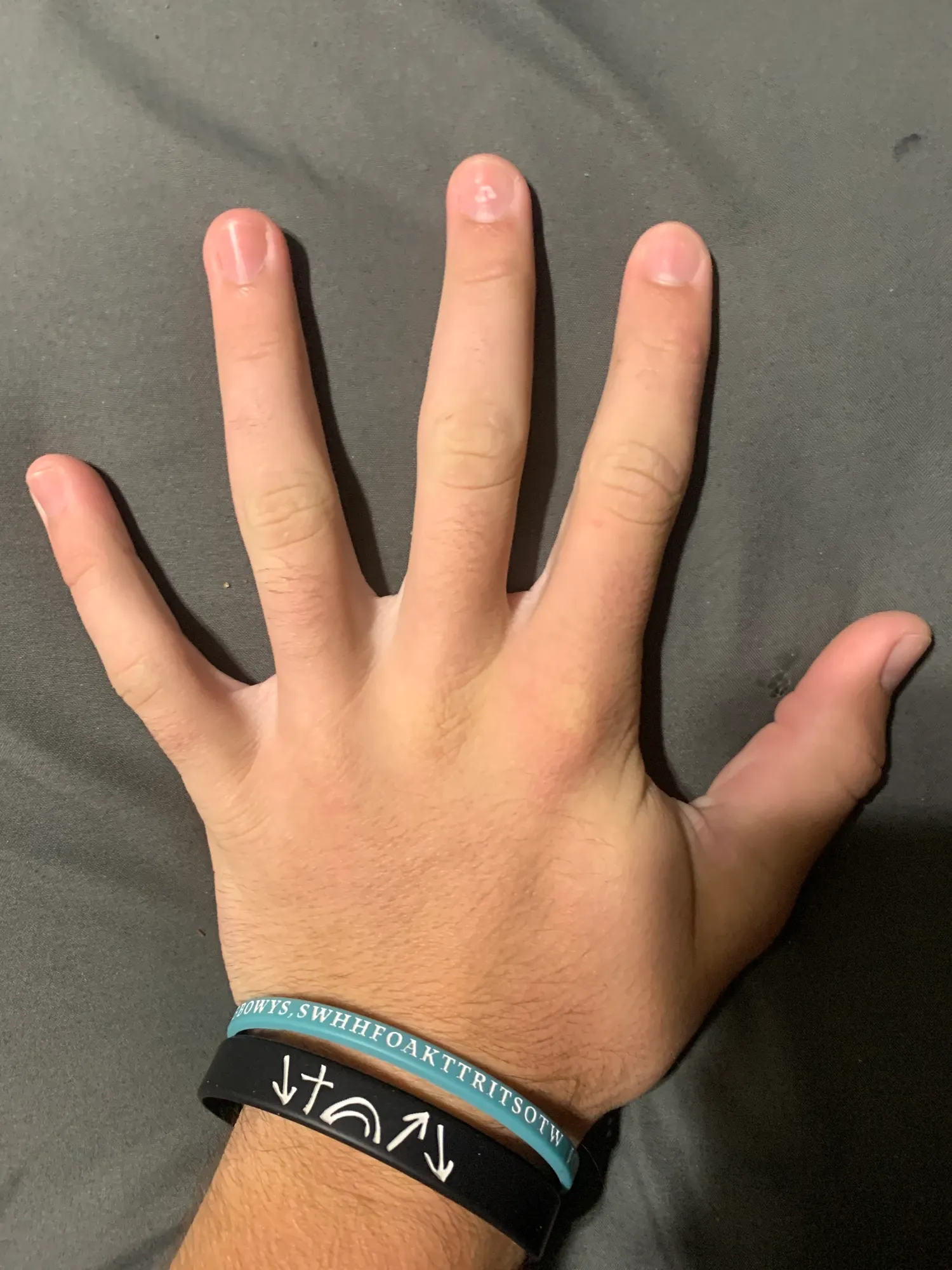 Hand, It Worked Once So Why Wouldnt It Work Again