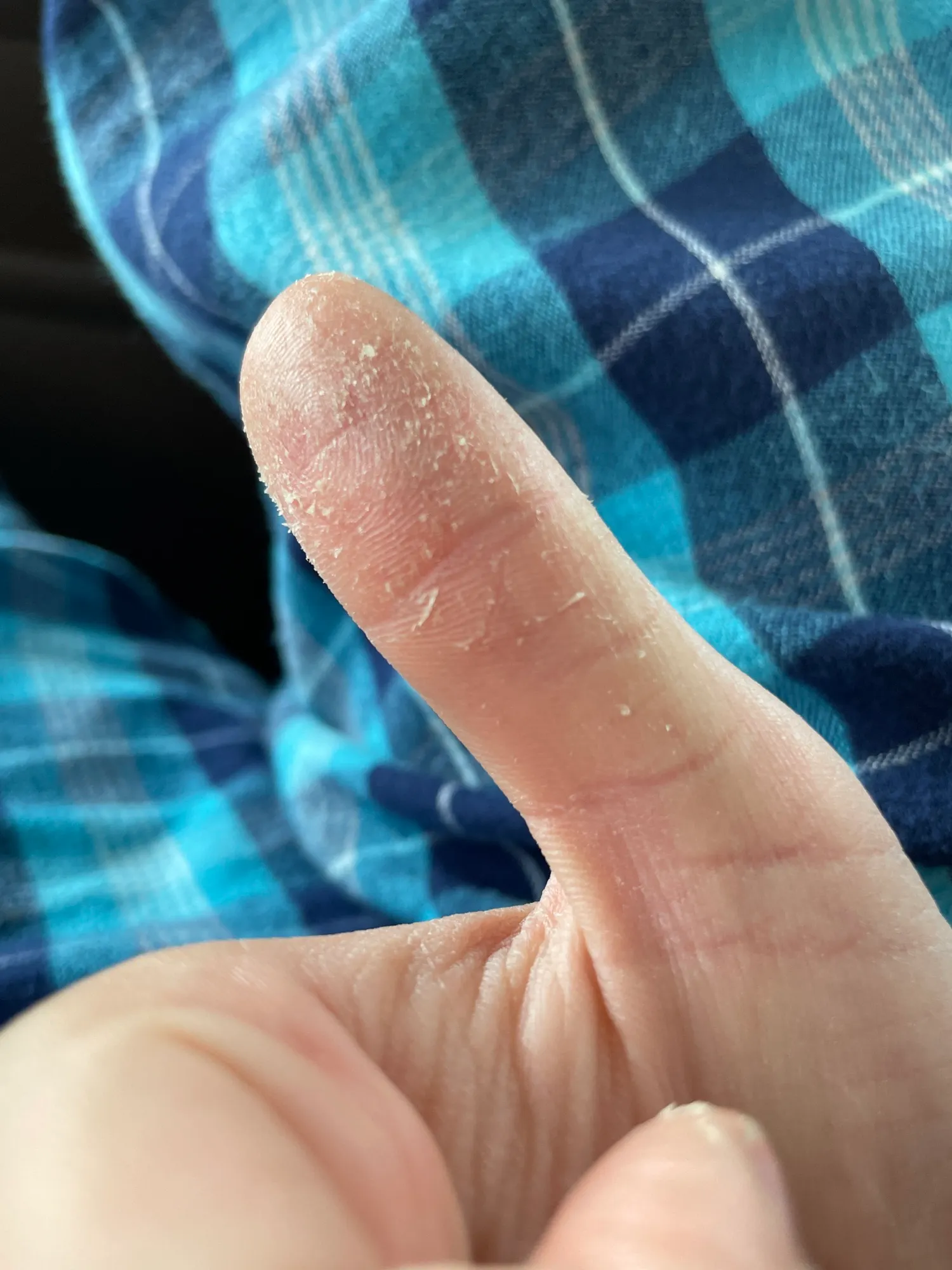 Bass Thumb